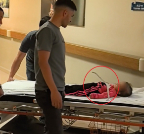 2 yaşındaki Meryem’in oynadığı askı çenesine saplandı