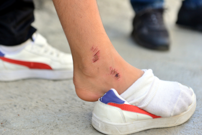 Kovaladığı çocuğu ayak bileğinden tutup yere fırlatan şüpheli tutuklandı (2)